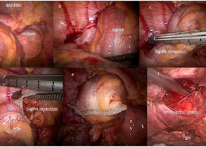 Giuseppe Brotzu Hospital Frontiers | Survival as a clinical outcome and its spiritual ... photo